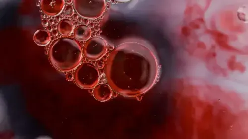 Can Stress Cause Blood Clots?